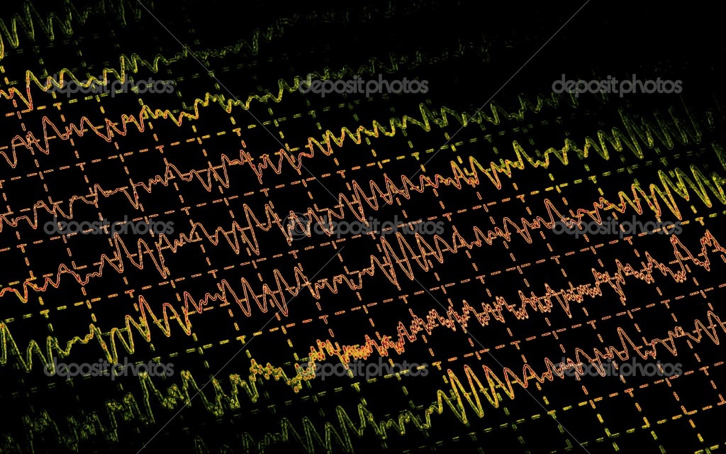 electroencephalogramme2