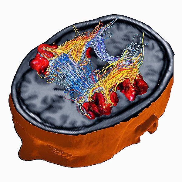 electroencephalogramme3