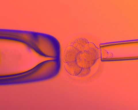 The alarming rise of genetic testing to select embryos