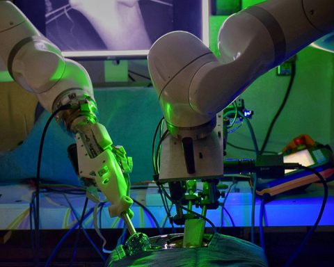 Les robots pourraient-ils prendre le scalpel du chirurgien ?