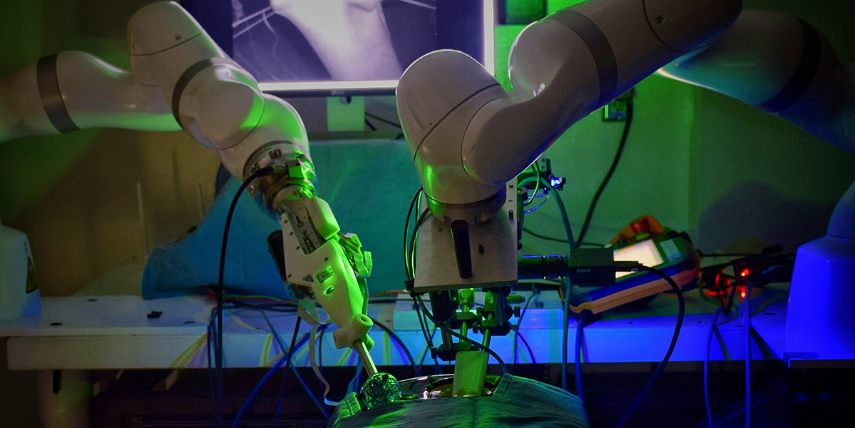 Could robots take over the surgeon's scalpel?