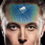 Mystère autour des implants cérébraux d’Elon Musk