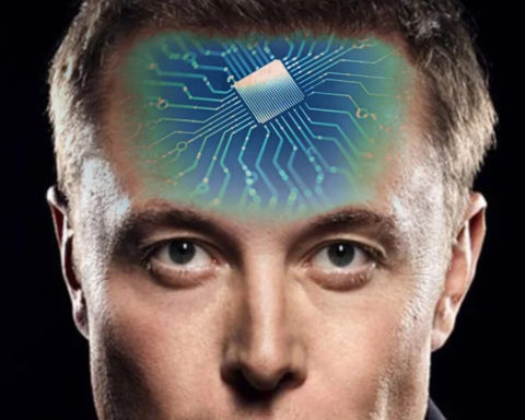 Mystery surrounding Elon Musk's brain implants