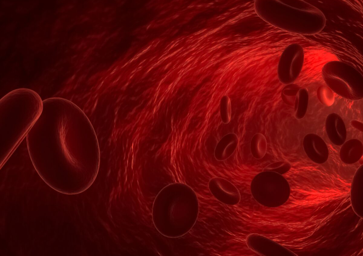 La thérapie aux nanoparticules pourrait éliminer l'accumulation de plaque dans les artères