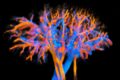 Imagerie médicale : la 4D révolutionne l’observation des flux sanguins